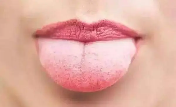 这么多种舌苔有你的吗 哔哩哔哩
