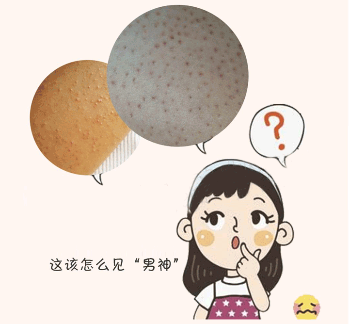 家里怎么去除鸡皮肤(家里怎么去除鸡皮肤的小妙招)