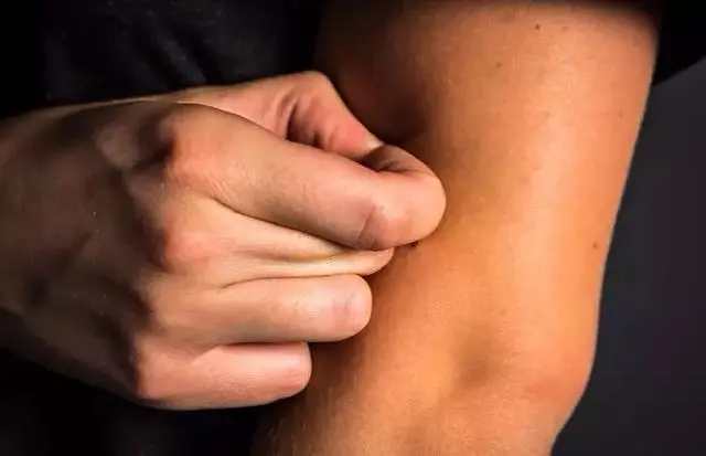 撕了那么多年死皮 才发现原来是我有病 哔哩哔哩