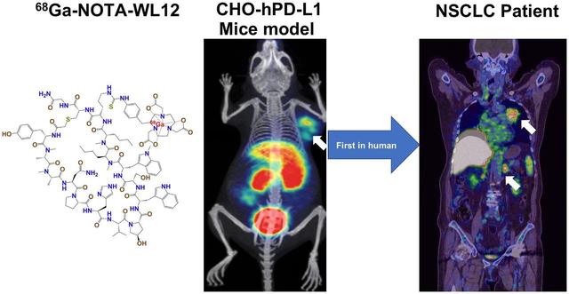 NOTA-WL12｜NOTA-Peptide｜NOTA-PD-L1，WL12 可以通过不同的放射性核素进行放射性标记 - 哔哩哔哩