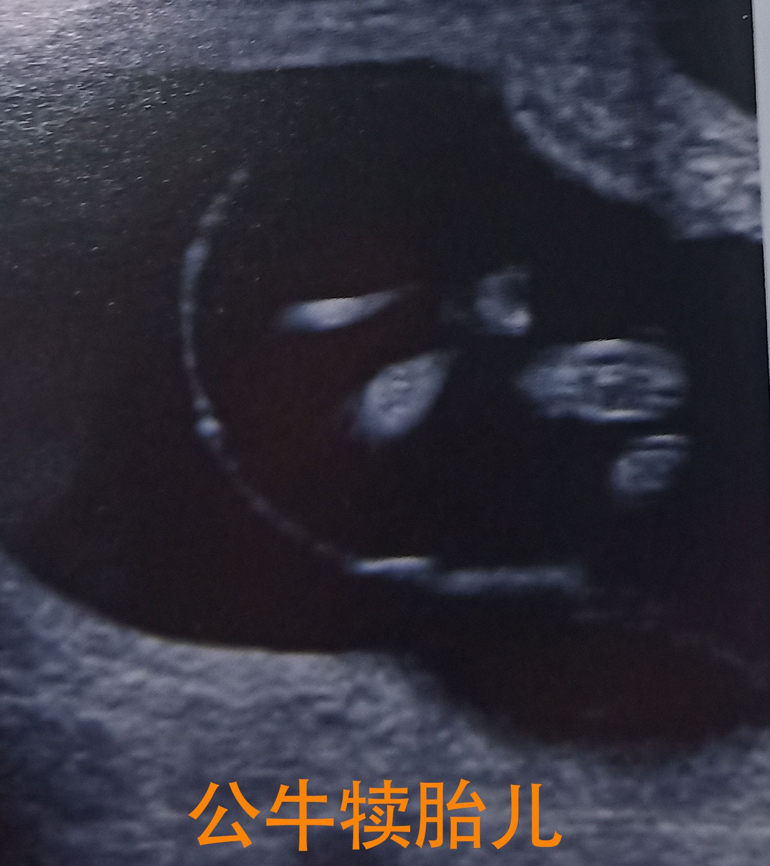 宁夏灵武：首次成功实现奶牛体外生产胚胎批量繁育 _光明网
