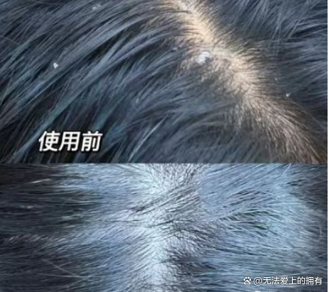 去屑保湿洗发水怎么样?顶级设计师珍品推荐 - 哔哩哔哩