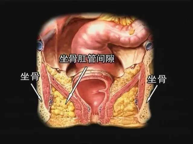 直肠肛管周围间隙