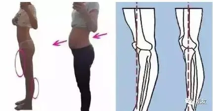 妹子 你这不是翘臀 是骨盆前倾 哔哩哔哩
