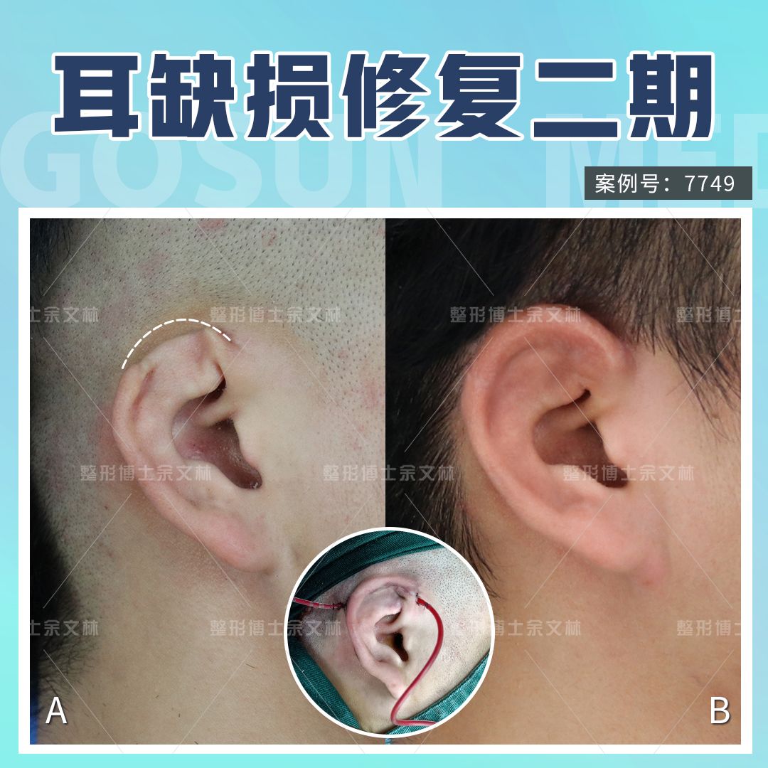 耳解剖。人类耳朵结构的特写。插画图片素材_ID:409120104-Veer图库