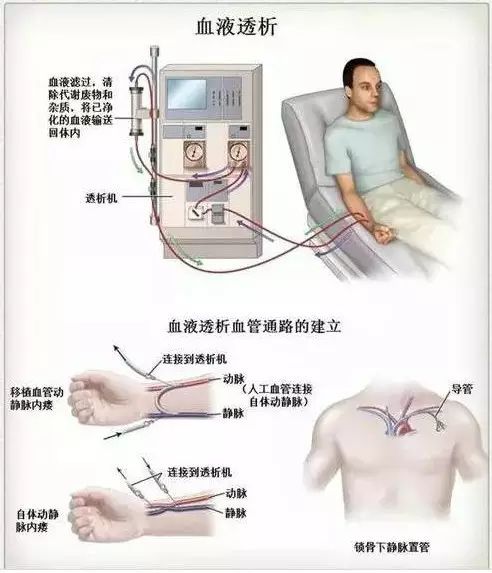 常见临床操作图解 哔哩哔哩