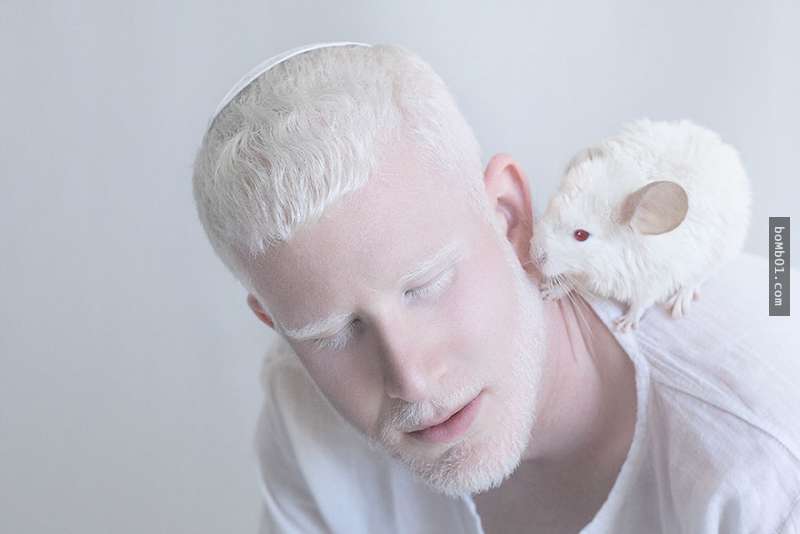 关于白化,你知道多少?