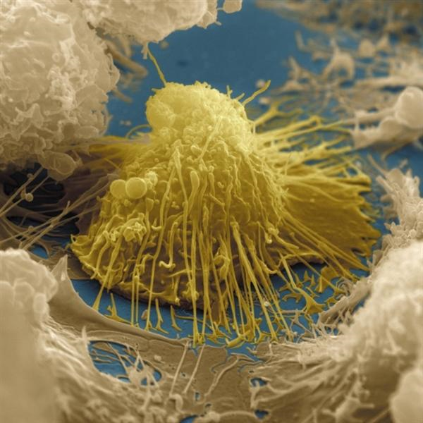 曾热度 《工作细胞》里的一些介绍—————②淋巴细胞们