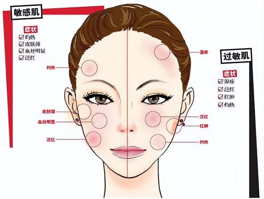 脸上红敏感泛红怎么办？皮肤科医生教你4步修复皮肤屏障，轻松远离泛红干痒！