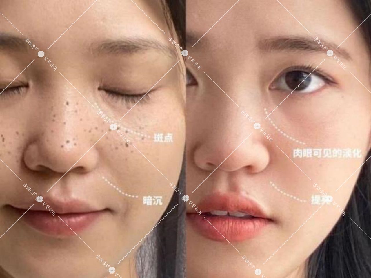 斑是怎么形成的有几种原因（女性脸上突然长斑了？或是这3个原因，奉劝你重视） | 说明书网
