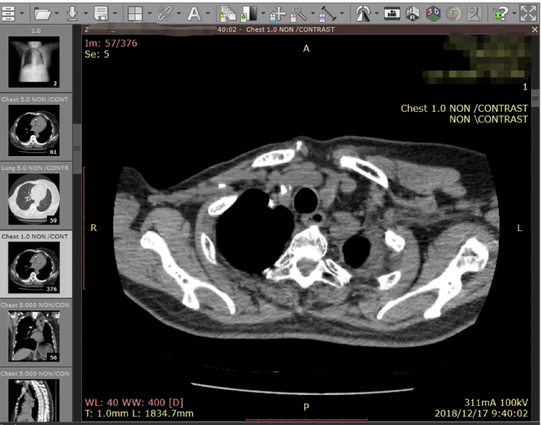 什么是DICOM格式医学影像？如何获取？ - 哔哩哔哩