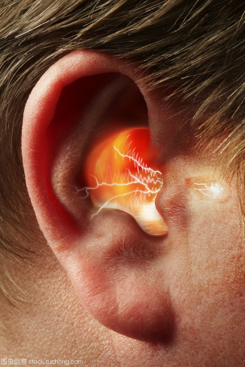 耳鸣脑鸣的久治不愈,原因竟是这个?