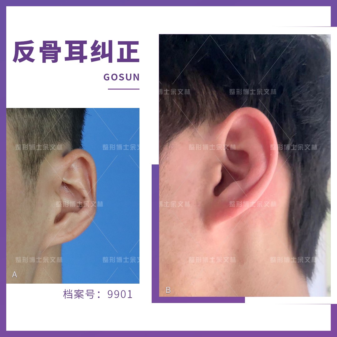 【耳（外耳・中耳・内耳）と鼻の構造と機能】音の伝わり方とは？ vol.54 - 介護ラボ