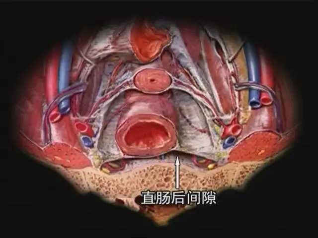直肠肛管周围间隙