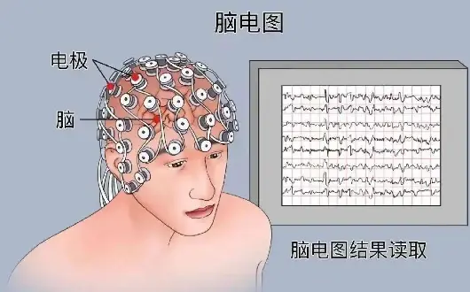 1987全國首台術中腦皮質腦波電極儀