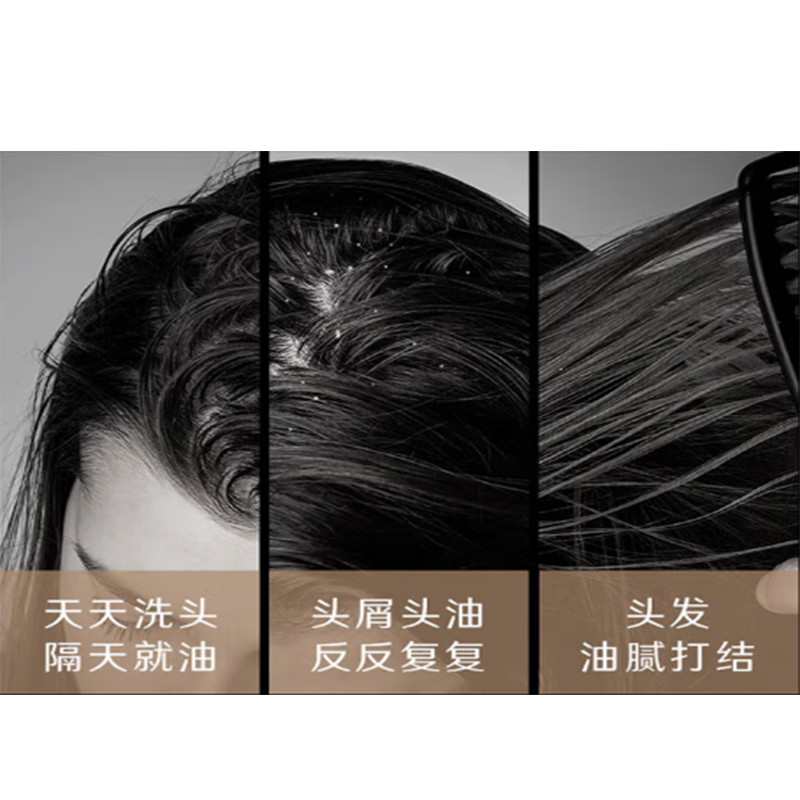 去屑止痒洗发水哪款好适合青少年?【长效秀发焕发】 - 哔哩哔哩