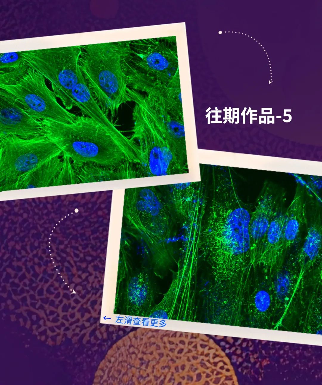 Pirtobrutinib (LOXO-305) 是一种高度选择性的非共价下一代 BTK 抑制剂 |(MCE) - 哔哩哔哩