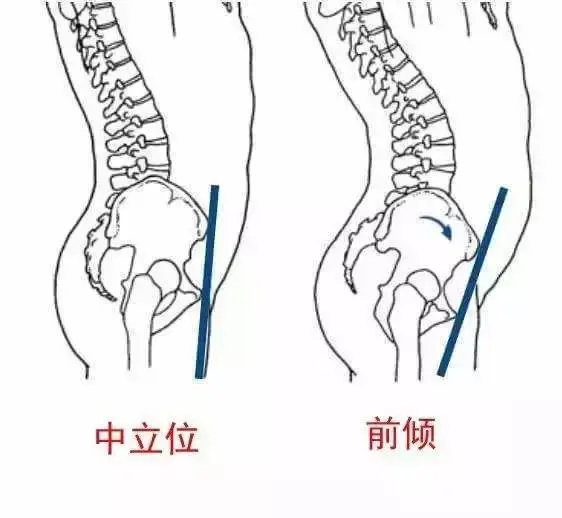妹子 你这不是翘臀 是骨盆前倾 哔哩哔哩