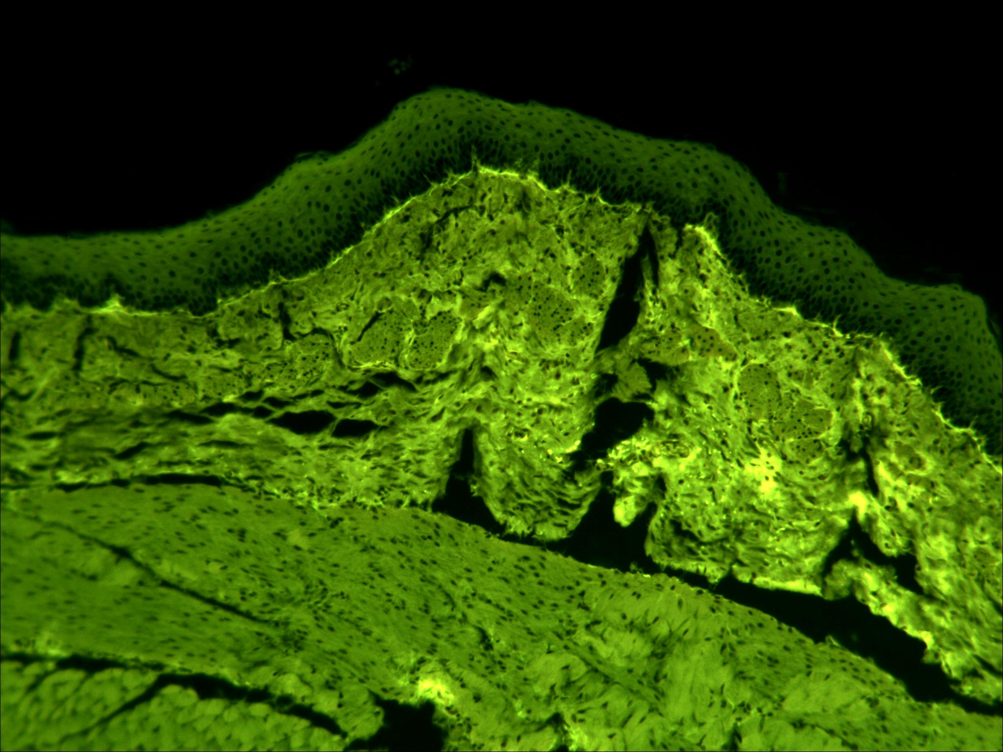 近期拍的一些荧光图片