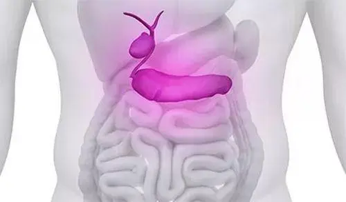 胆管癌早期很像胆结石 出现这几个症状黄俭主任说就要小心了 哔哩哔哩