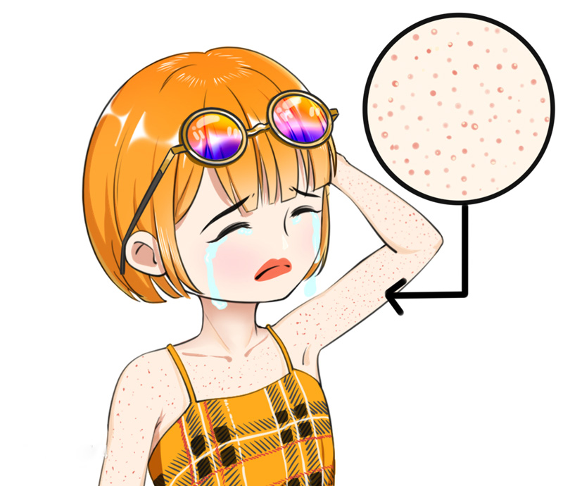 鸡皮肤怎么传染别人(鸡的皮肤病会传染人吗)