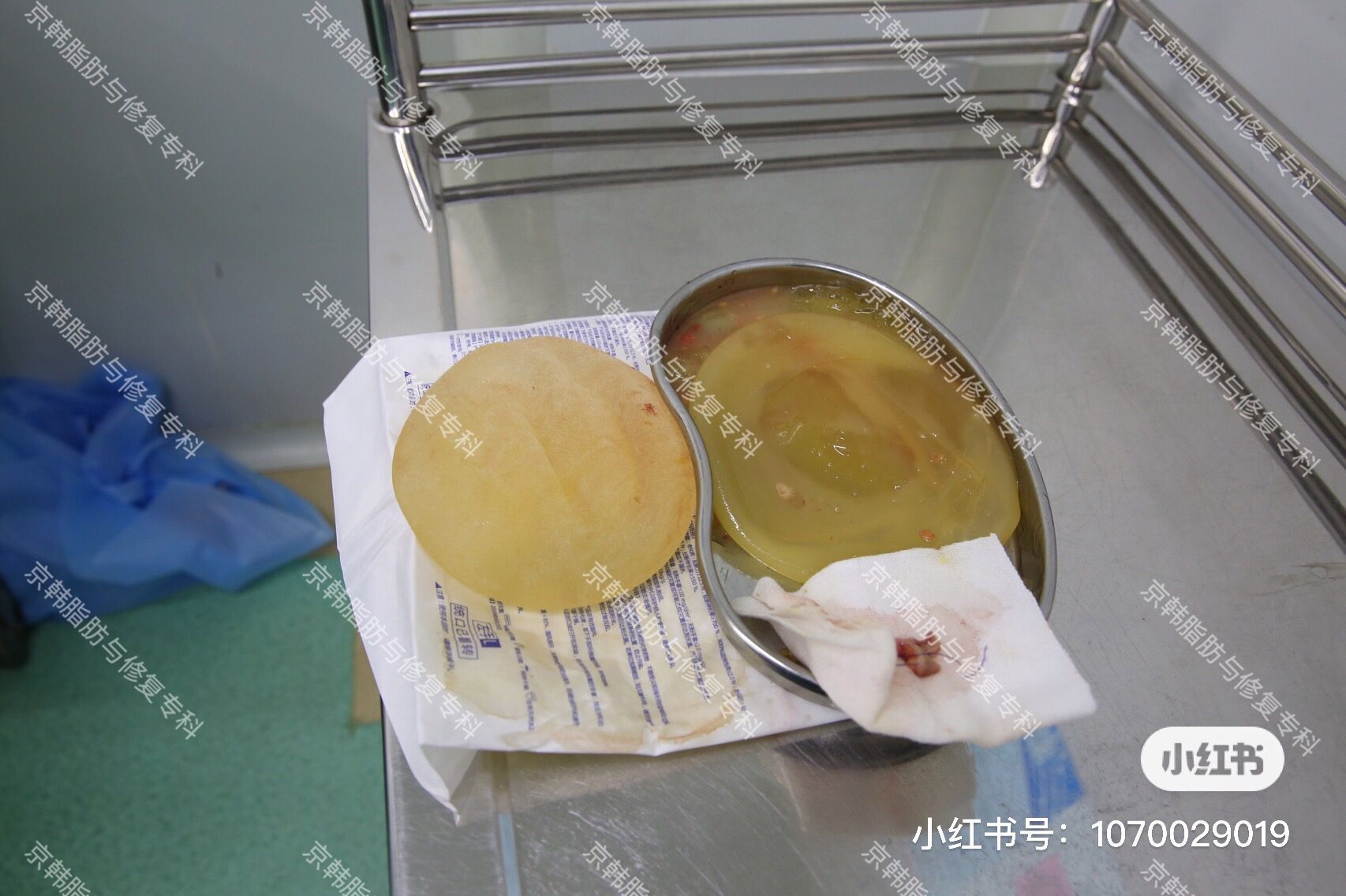 术中取出的不同类型#胸部硅胶假体