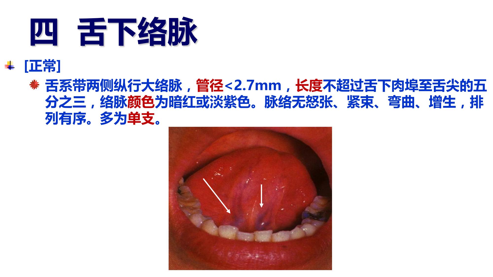 抖音舌诊哥：舌诊知健康，教你学会看舌象系列四十八 - 知乎