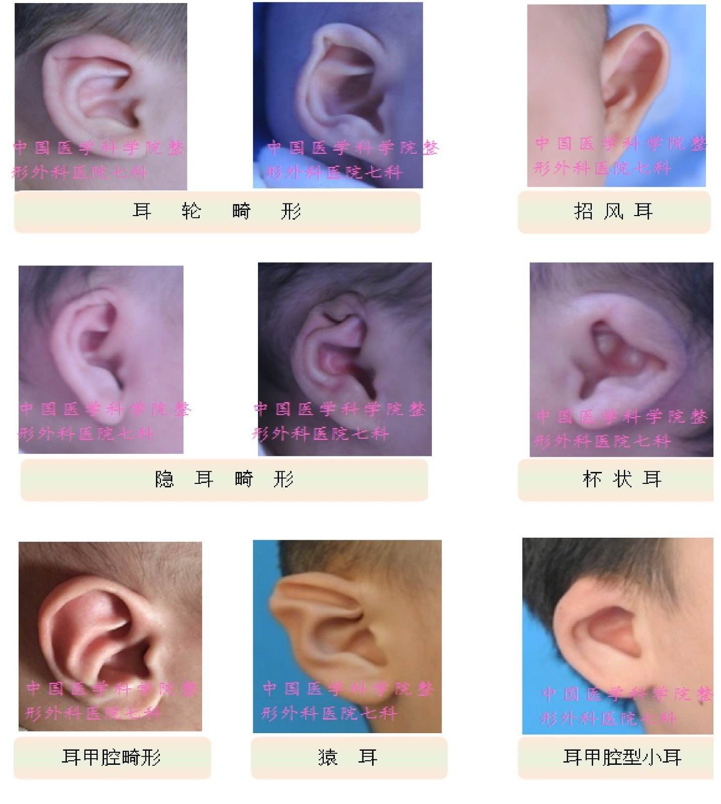 二、外耳道-人体解剖学与组织胚胎学-医学