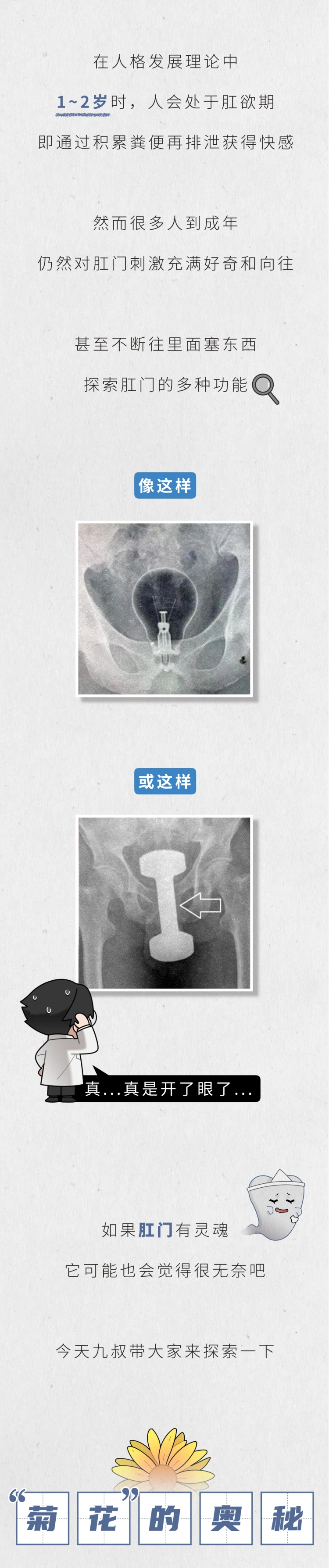 人类的肛门到底可以塞进多少东西1
