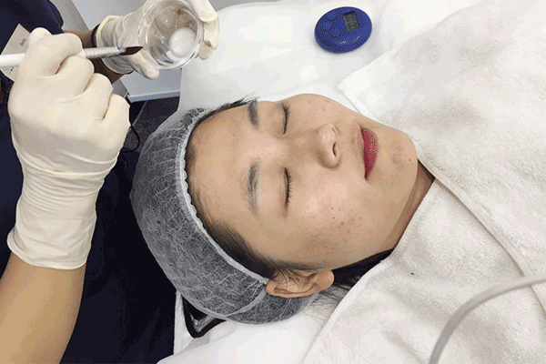 所有肌肤都适合刷酸吗有哪些注意事项呢