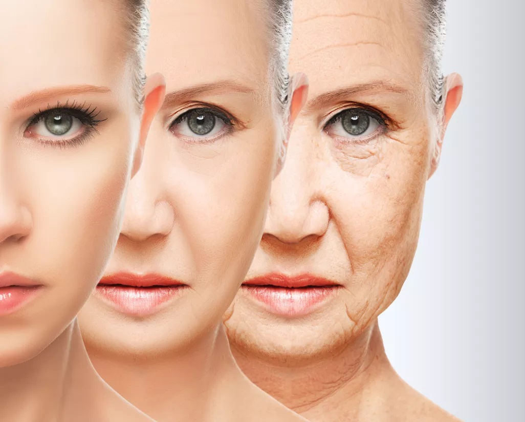 苹果肌不是孤立存在的,在面部发生动态笑容时,鼻翼,上唇,口角肌肉都会