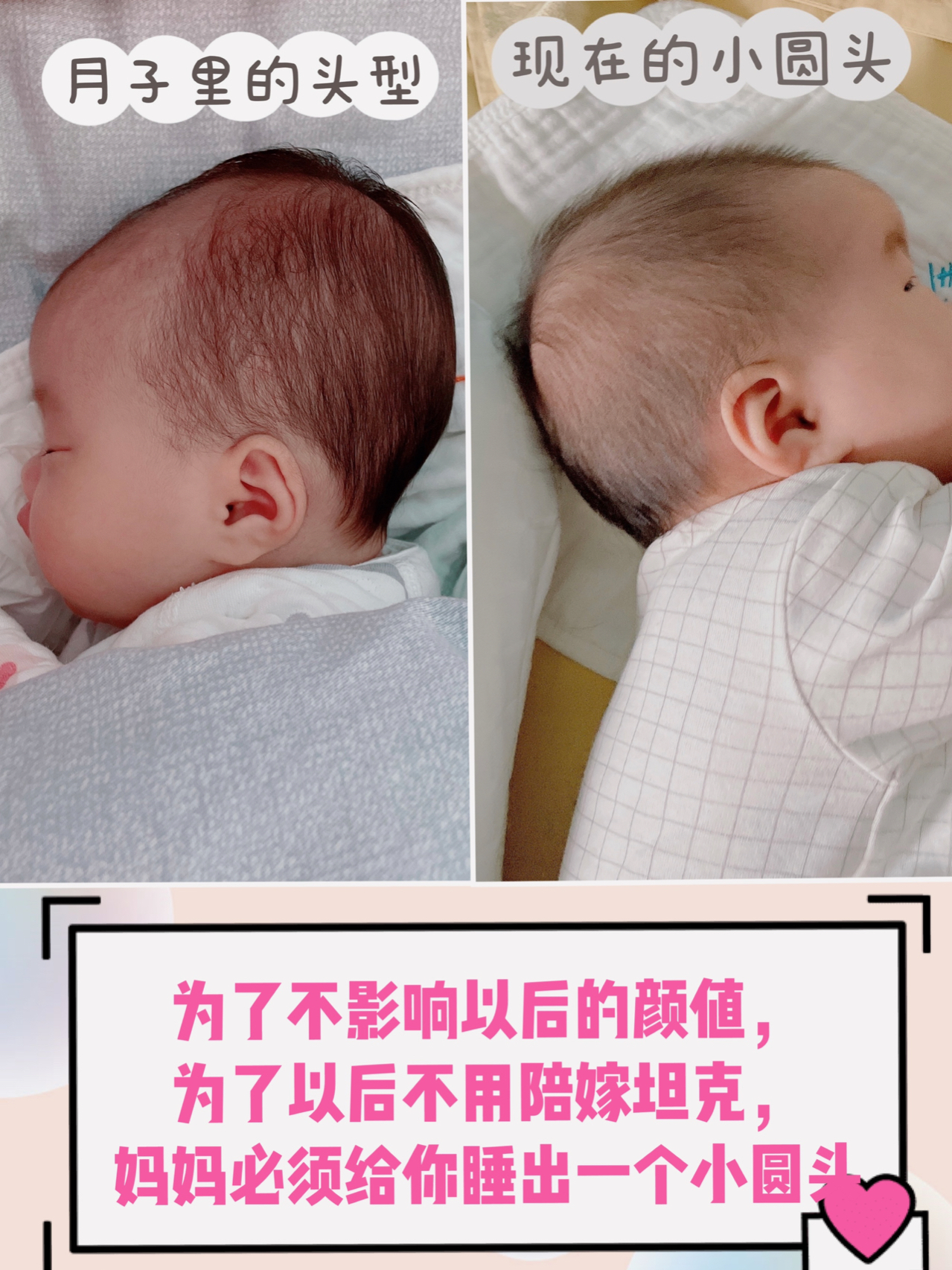 【宝宝头型】教你如何睡出小圆头！|||️常见正常问题头型特征 - 知乎