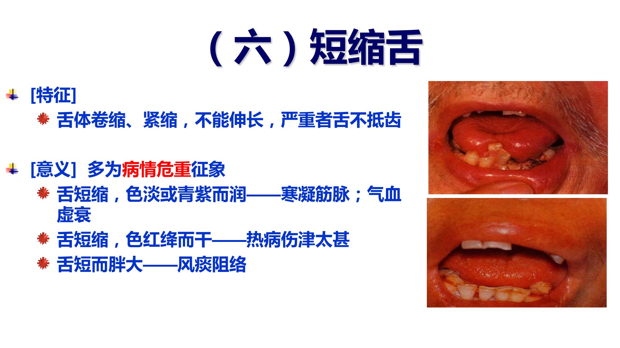 从零开始学中医:望舌态 - 哔哩哔哩