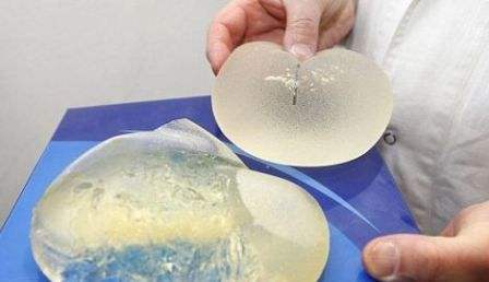 隆胸修复方法1,人造脂肪注射隆胸取出术:一次能够祛除注射隆胸物98%