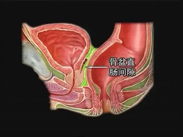 直肠肛管周围间隙