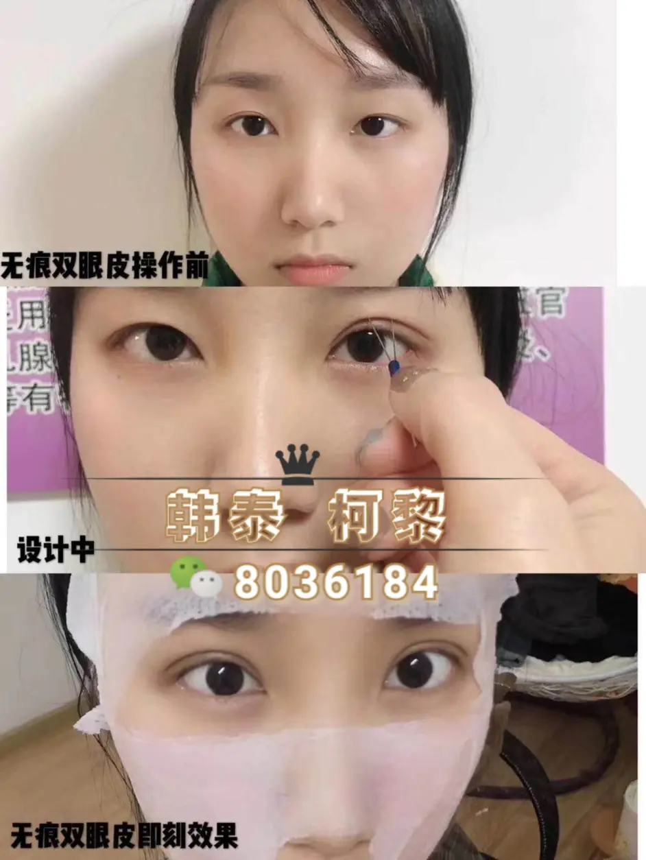 大小眼明星 有人怀疑余文乐一只眼睛是不是假的 陈冠希