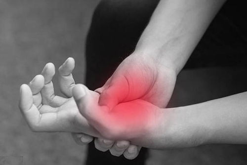 痛风患者平日里运动有哪些需要注意的?