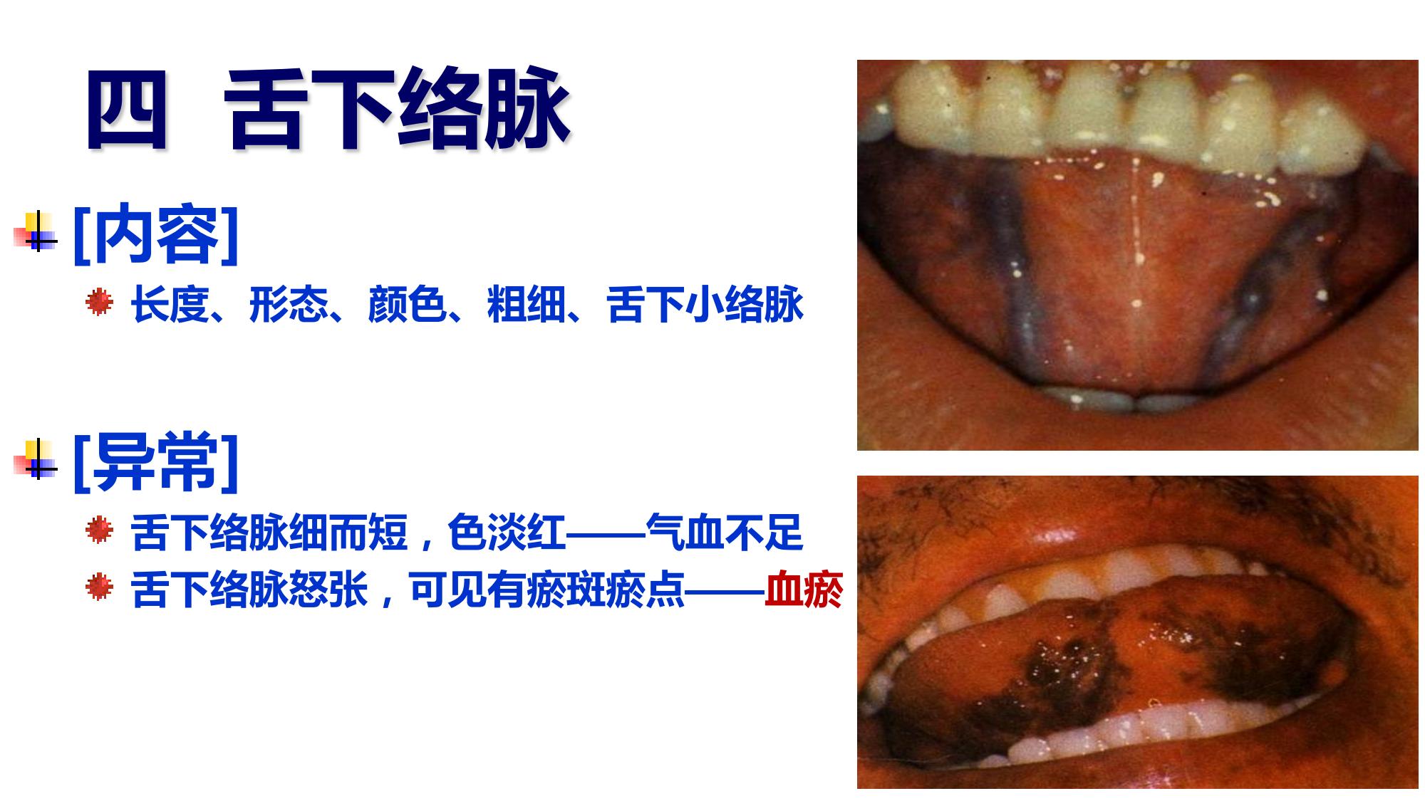 1.1.3 舌下腺囊肿-口腔颌面肿瘤手术-医学