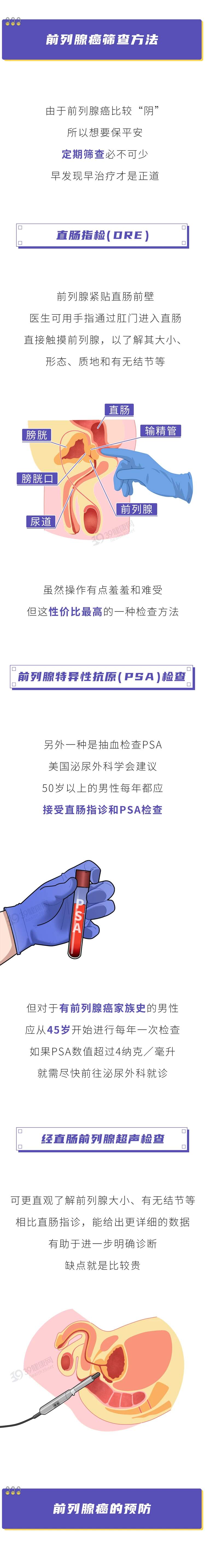 前列腺癌一发现就是晚期5