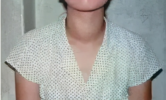 脖子越粗,血管越差! "一般来说,脖子粗细和肥胖程度有着