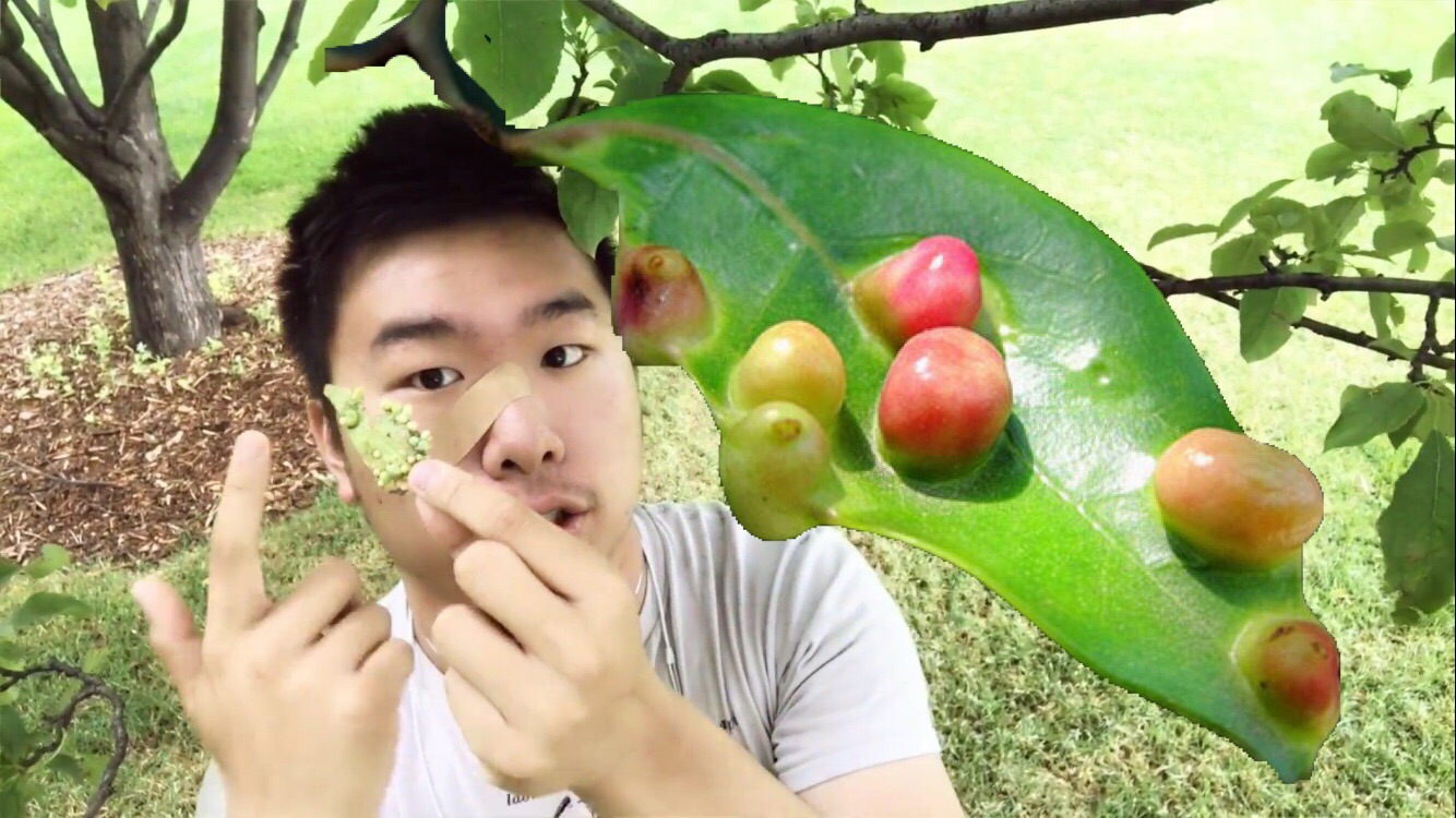 吸血飞虫小咬袭卷东北究竟是什么恐怖的虫子