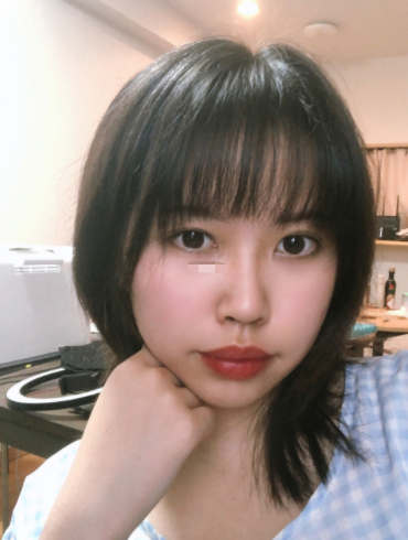 埋线双眼皮最快多久自然 7d3e70dd6c24e0bed730c1230a9d9a6dc262a386.jpg