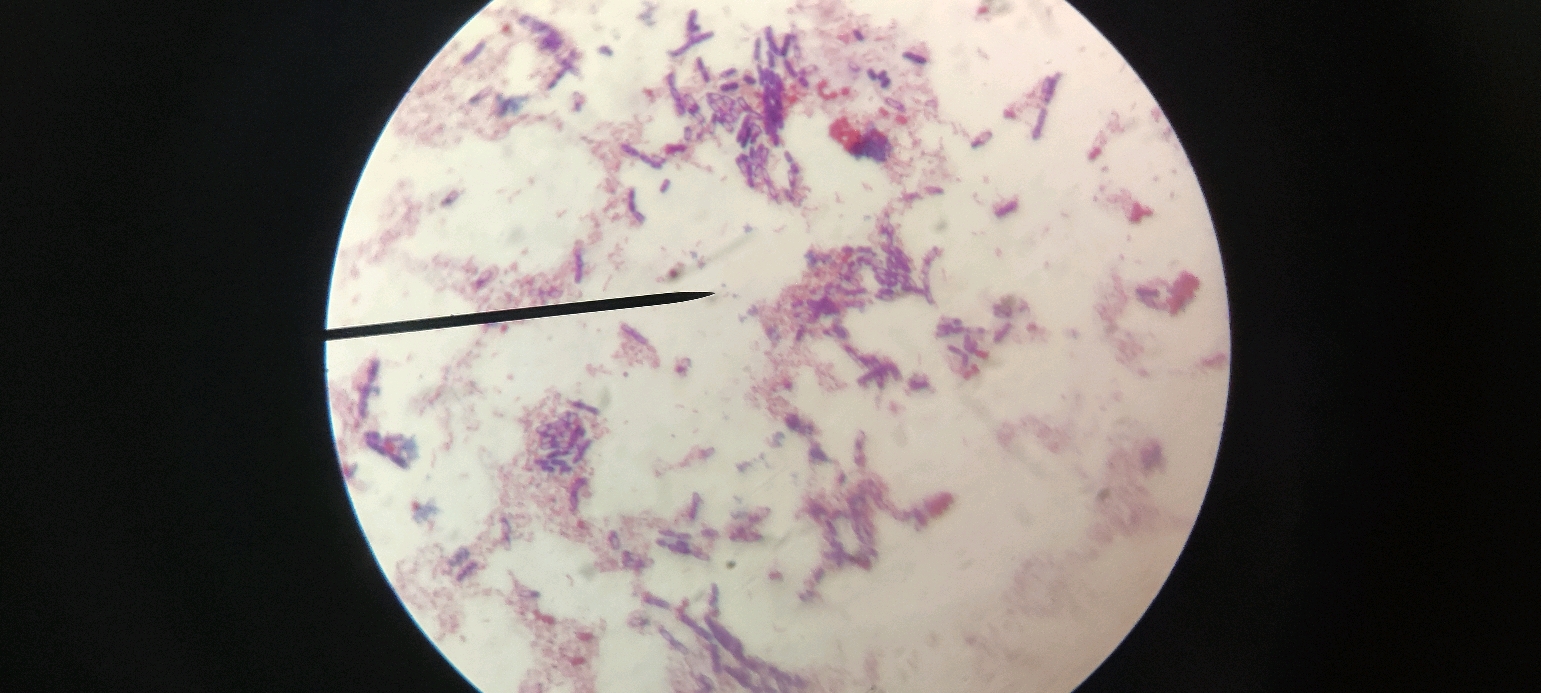 大肠杆菌美蓝染色图片