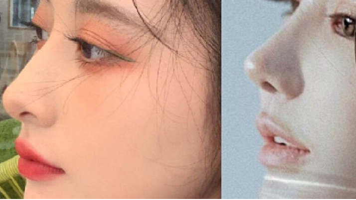 厦门隆鼻|鼻子怎么做才会自然又好看?