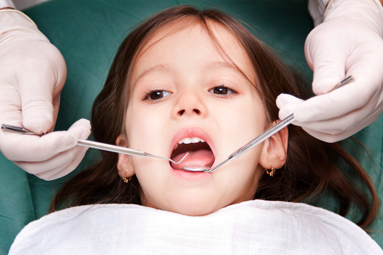 Early Childhood Caries | Toddler Tooth Decay