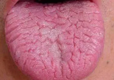 这么多种舌苔有你的吗 哔哩哔哩