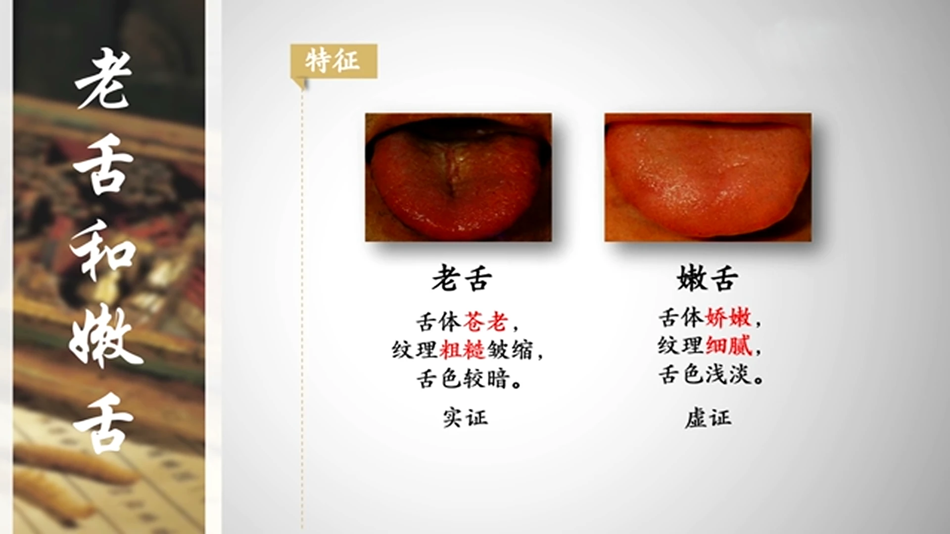 从零开始学中医：望舌形 哔哩哔哩