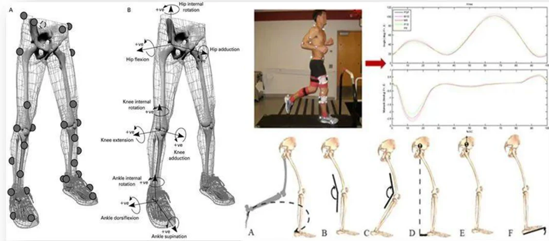 什么是ACF人工软骨鞋垫？探索ACF人工软骨鞋垫的起源与研发、结构 - 哔哩哔哩