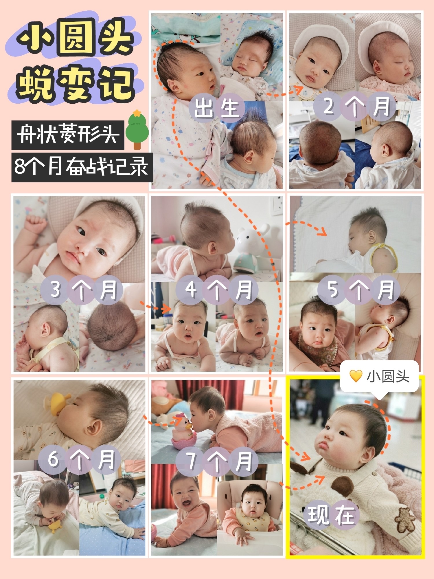 婴儿畸形图片,标本(第4页)_大山谷图库