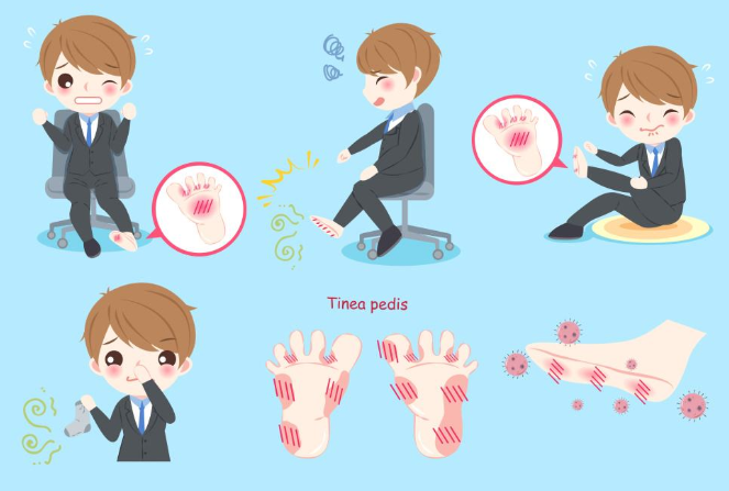 如何分辨脚臭与脚气两者不同